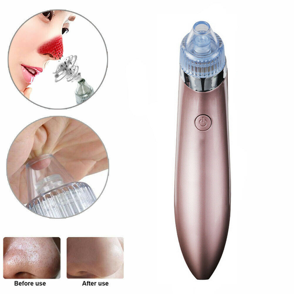 Electric Blackhead Vacuum Pore Cleaner Acne Pimple Remover Strong Suction Tool Electric Blackhead Remover Pore Vacuum Suction Diamond Dermabrasion Face Cleaner - MAGM Enterprises LLC