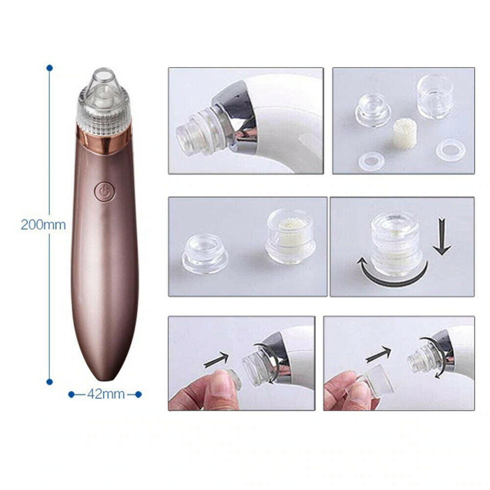 Electric Blackhead Vacuum Pore Cleaner Acne Pimple Remover Strong Suction Tool Electric Blackhead Remover Pore Vacuum Suction Diamond Dermabrasion Face Cleaner - MAGM Enterprises LLC