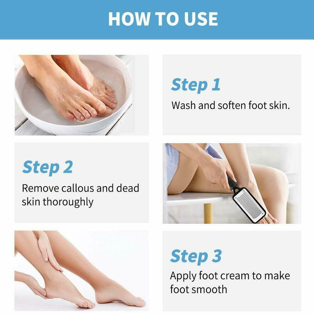 Professional Foot Callus Remover File Rasp Scraper Cracked Pedicure Rough Tool - Mag Max Mart