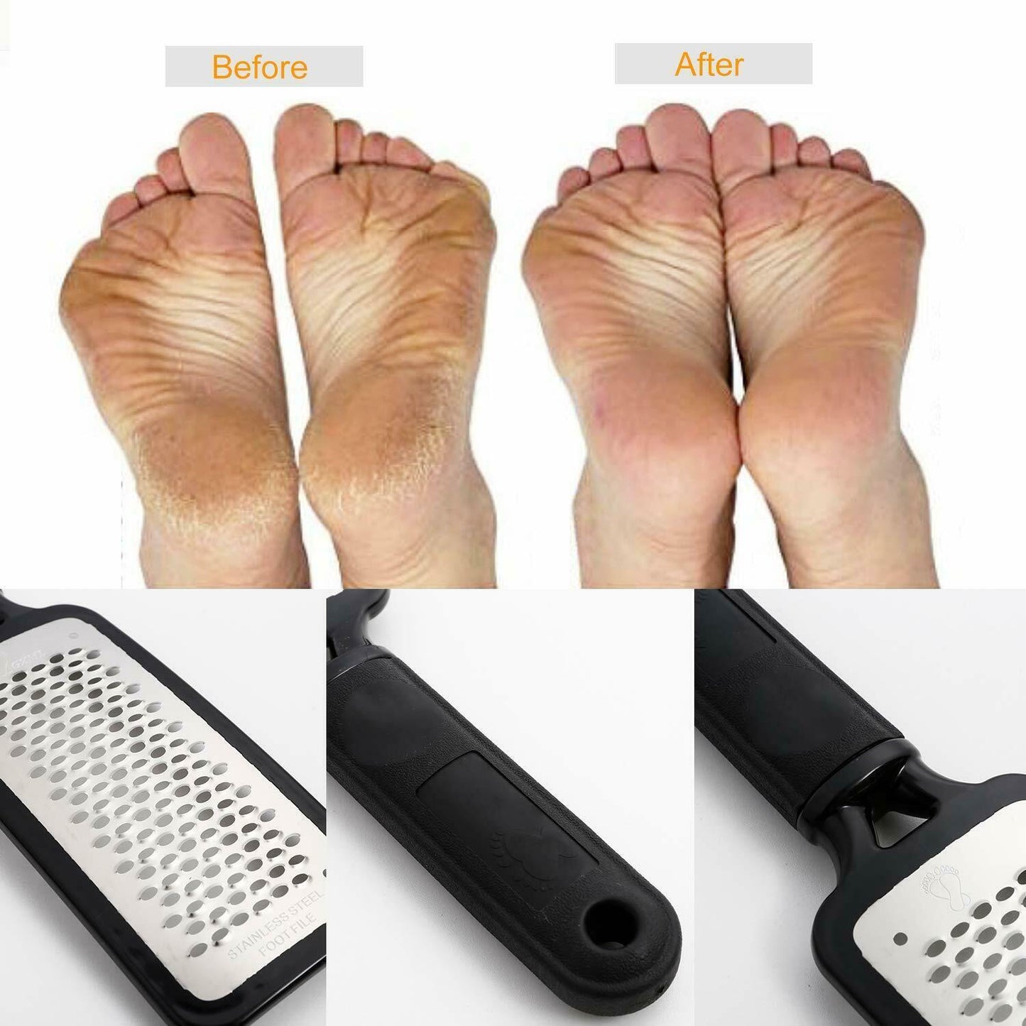 Professional Foot Callus Remover File Rasp Scraper Cracked Pedicure Rough Tool - Mag Max Mart