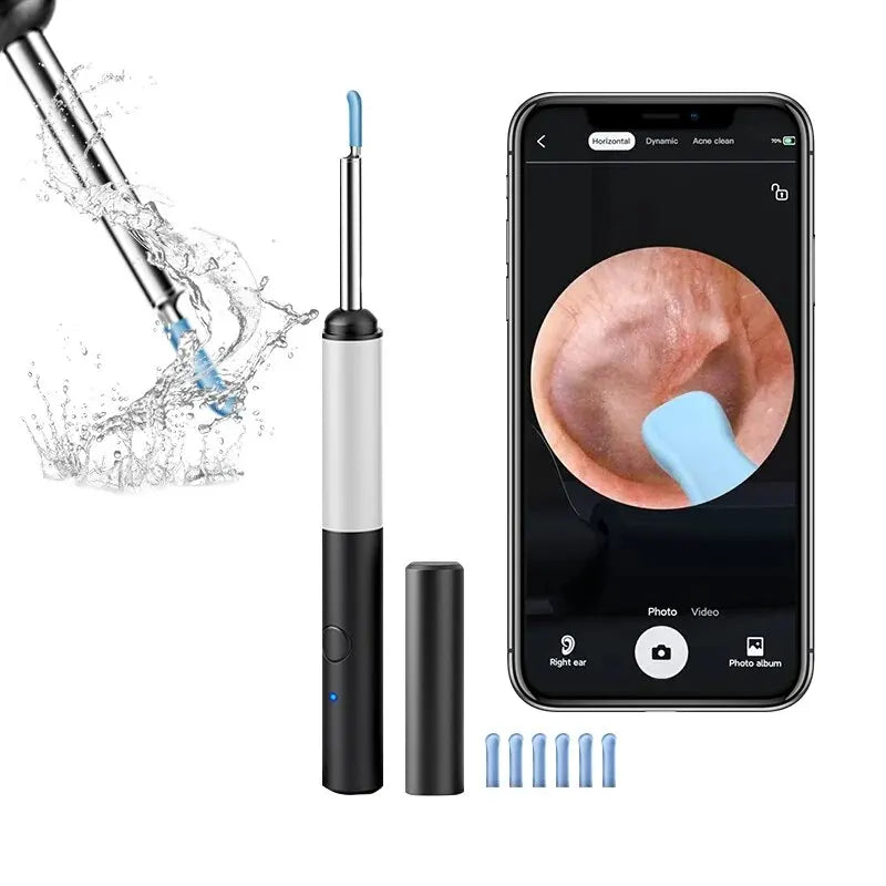 Wireless Otoscope 3.5mm Ultra-Thin WiFi Ear Scope Camera with Earwax - MAGM Enterprises LLC