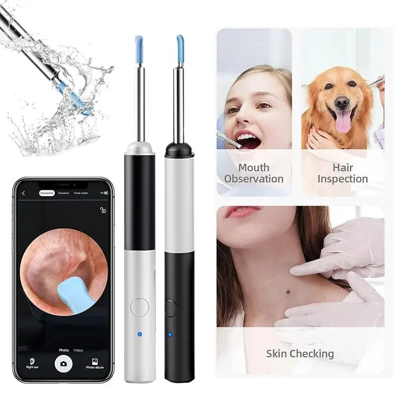 Wireless Otoscope 3.5mm Ultra-Thin WiFi Ear Scope Camera with Earwax - MAGM Enterprises LLC