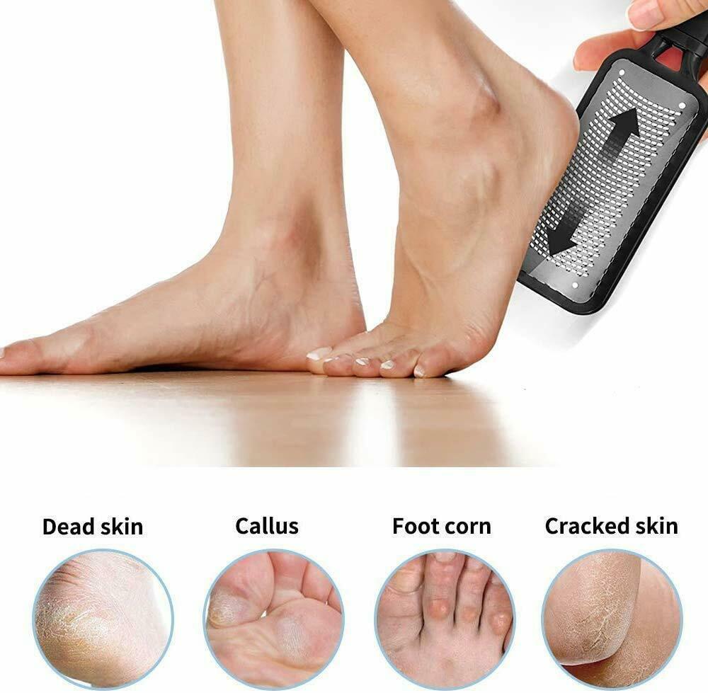 Professional Foot Callus Remover File Rasp Scraper Cracked Pedicure Rough Tool - Mag Max Mart