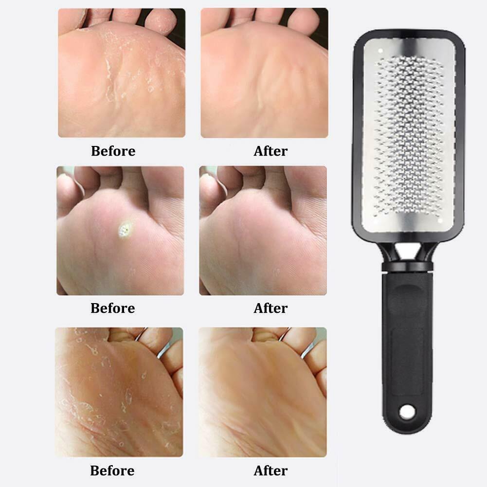 Professional Foot Callus Remover File Rasp Scraper Cracked Pedicure Rough Tool - Mag Max Mart