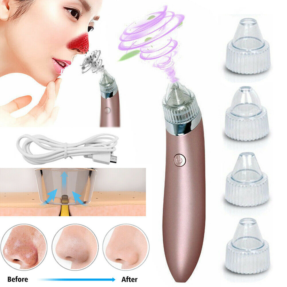 Electric Blackhead Vacuum Pore Cleaner Acne Pimple Remover Strong Suction Tool Electric Blackhead Remover Pore Vacuum Suction Diamond Dermabrasion Face Cleaner - MAGM Enterprises LLC