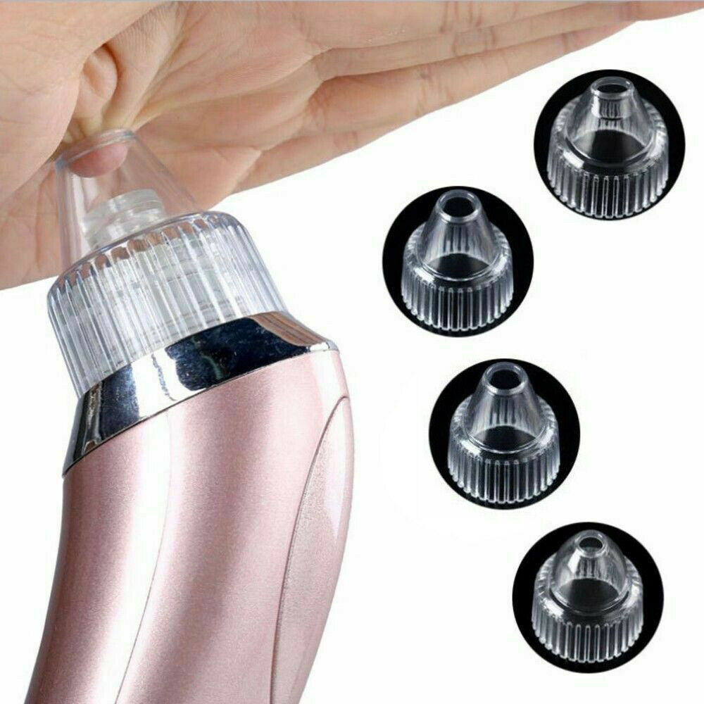 Electric Blackhead Vacuum Pore Cleaner Acne Pimple Remover Strong Suction Tool Electric Blackhead Remover Pore Vacuum Suction Diamond Dermabrasion Face Cleaner - MAGM Enterprises LLC